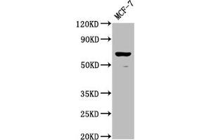Western Blot Positive WB detected in: MCF-7 whole cell lysate All lanes: RPE65 antibody at 1:2000 Secondary Goat polyclonal to rabbit IgG at 1/50000 dilution Predicted band size: 61 kDa Observed band size: 61 kDa (RPE65 抗体  (AA 348-484))