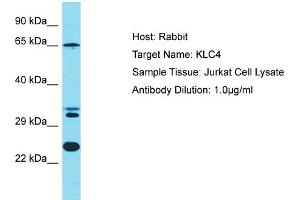 Host: Rabbit Target Name: KLC4 Sample Tissue: Human Jurkat Whole Cell Antibody Dilution: 1ug/ml (KLC4 抗体  (N-Term))