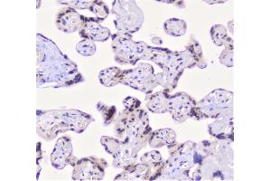 IHC analysis of CFP using anti-CFP antibody (ABIN6719298).