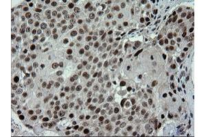Image no. 9 for anti-tRNA Methyltransferase 2 Homolog A (TRMT2A) antibody (ABIN1501516)