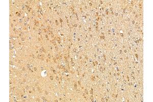 ABIN7094858 and ABIN7098909 at 1/100 staining Rat brain tissue by IHC-P.