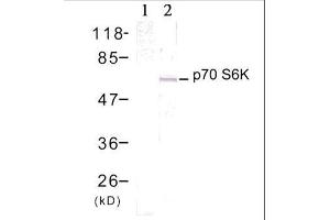 Western blot analysis of extract from 293 cells treated with EGF (200ng/ml, 15min), using p70 S6 Kinase (Ab-389) antibody (E021182, Lane 1 and 2). (RPS6KB1 抗体)