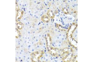 Immunohistochemistry of paraffin-embedded rat kidney using CGB7 antibody (ABIN5974696) at dilution of 1/100 (40x lens). (CGB7 抗体)