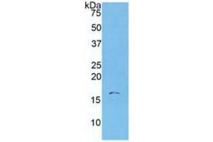 WB of Protein Standard: different control antibodies  against Highly purified E. (S100A6 ELISA 试剂盒)