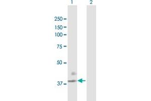 Western Blotting (WB) image for anti-Coagulation Factor III (thromboplastin, Tissue Factor) (F3) (AA 1-295) antibody (ABIN515444)