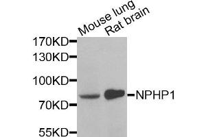 Western blot analysis of extracts of various cells, using NPHP1 antibody. (NPHP1 抗体)
