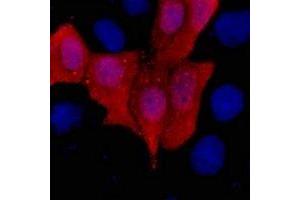 Immunofluorescent analysis of His-tag staining in 293T cells transfected with a His-tag protein. (His Tag 抗体)