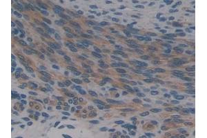 Immunohistochemistry (IHC) image for anti-ATP-Binding Cassette, Sub-Family C (CFTR/MRP), Member 1 (ABCC1) (AA 1219-1469) antibody (ABIN7440026)