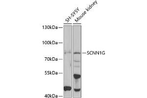 Western blot analysis of extracts of various cell lines, using SCNN1G antibody (ABIN6129468, ABIN6147453, ABIN6147454 and ABIN6221724) at 1:1000 dilution. (SCNN1G 抗体  (AA 85-355))
