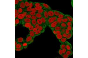 Immunofluorescence Analysis of human MCF-7 cells labeling CHP2 with CHP2 Mouse Monoclonal Antibody (CPTC-CHP2-1) followed by Goat anti-Mouse IgG-CF488 (Green). (Chp2 抗体)