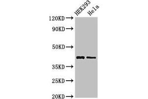 Western Blot Positive WB detected in: HEK293 whole cell lysate, Hela whole cell lysate All lanes: GALK1 antibody at 3 μg/mL Secondary Goat polyclonal to rabbit IgG at 1/50000 dilution Predicted band size: 43, 46 kDa Observed band size: 43 kDa (GALK1 抗体  (AA 23-164))