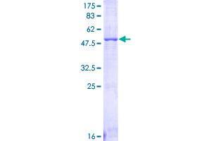 Image no. 1 for Fc Fragment of IgG, Low Affinity IIIa, Receptor (CD16a) (FCGR3A) (AA 17-254) protein (GST tag) (ABIN1353901)