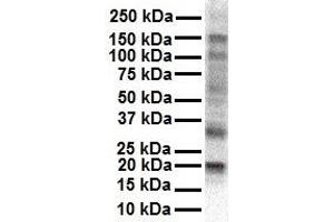 WB Suggested Anti-KCNAB2 antibody Titration: 1 ug/mL Sample Type: Human HepG2 (KCNAB2 抗体  (Middle Region))