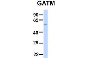 Host:  Rabbit  Target Name:  SERPINA3  Sample Type:  Human Adult Placenta  Antibody Dilution:  1. (GATM 抗体  (Middle Region))