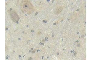 Immunohistochemistry (IHC) image for anti-Tumor Necrosis Factor (Ligand) Superfamily, Member 11 (TNFSF11) (AA 106-240) antibody (ABIN7432757)