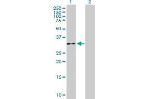 Western Blot analysis of WDR61 expression in transfected 293T cell line by WDR61 MaxPab polyclonal antibody. (WDR61 抗体  (AA 1-305))