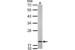 WB Image Sample (50 ug of whole cell lysate) A: mouse brain 12% SDS PAGE antibody diluted at 1:1000 (LMO1 抗体)