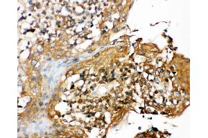 Anti-CIAS1/NALP3 antibody, IHC(P) IHC(P): Human Tonsil Tissue (NLRP3 抗体  (N-Term))