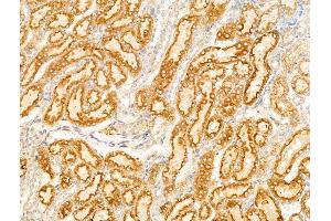 ABIN7094760 and ABIN7098811 at 1/100 staining Rat kidney tissue by IHC-P.