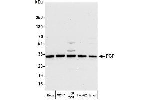anti-Phosphoglycolate Phosphatase (PGP) (AA 271-321) antibody