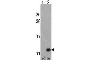 Western blot analysis of URM1 polyclonal antibody . (Urm1 抗体  (N-Term))