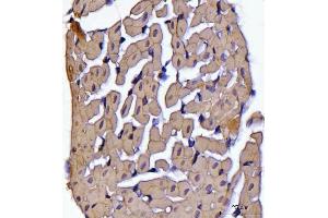 IHC analysis of ATP5F1B using anti-ATP5F1B antibody (ABIN7599866). (Atp5f1b (AA 123-529) 抗体)