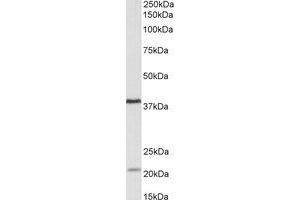 Western Blotting (WB) image for anti-Kelch Domain Containing 8B (KLHDC8B) (Internal Region) antibody (ABIN2464990) (KLHDC8B 抗体  (Internal Region))