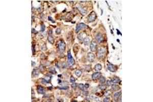 Image no. 2 for anti-Protein Inhibitor of Activated STAT, 4 (PIAS4) (C-Term) antibody (ABIN356771) (PIAS4 抗体  (C-Term))