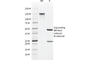 SDS-PAGE Analysis Purified Cytokeratin 18 Mouse Monoclonal Antibody (DC10). (Cytokeratin 18 抗体)