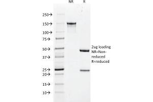 SDS-PAGE Analysis Purified Cytokeratin 18 Mouse Monoclonal Antibody (DC10).