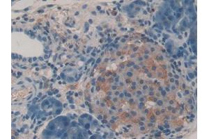 DAB staining on IHC-P; Samples: Rat Pancreas Tissue (IGF2R 抗体  (AA 1146-1363))