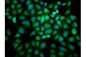 Immunofluorescence staining of Hela cells with ABIN7153405 at 1:166, counter-stained with DAPI. (Cyclin B2 抗体  (AA 7-163))