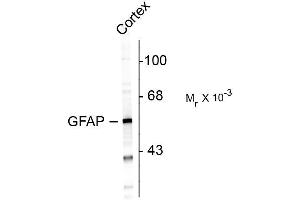 Western blots of rat cortex lysate showing specific immunolabeling of the ~ 50k GFAP protein. (GFAP 抗体)