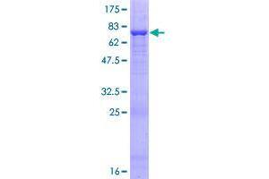 Image no. 1 for Queuine tRNA-Ribosyltransferase Domain Containing 1 (QTRTD1) (AA 1-415) protein (GST tag) (ABIN1317017) (QTRTD1 Protein (AA 1-415) (GST tag))