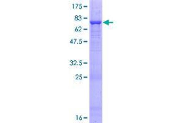 QTRTD1 Protein (AA 1-415) (GST tag)