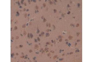 IHC-P analysis of brain tissue, with DAB staining. (Oligophrenin 1 抗体  (AA 634-802))