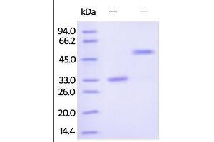 Human IgG2 Fc, Tag Free on SDS-PAGE under reducing (R) and no-reducing (NR) conditions. (HEK-293 Cells IgG2 同型对照)