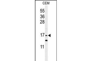Western blot analysis of GMFG Antibody (C-term) (ABIN652407 and ABIN2841991) in CEM cell line lysates (35 μg/lane). (GMFG 抗体  (C-Term))