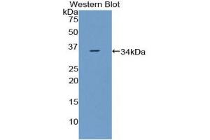 Western blot analysis of the recombinant protein. (CCDC80 抗体  (AA 635-906))
