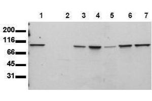 Western Blotting (WB) image for anti-Signal Transducer and Activator of Transcription 6, Interleukin-4 Induced (STAT6) antibody (ABIN126902) (STAT6 抗体)