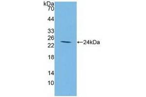 Detection of Recombinant IGFBP2, Human using Polyclonal Antibody to Insulin Like Growth Factor Binding Protein 2 (IGFBP2) (IGFBP2 抗体  (AA 148-325))