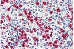 Human Spleen, Granulocytes (formalin-fixed, paraffin-embedded) stained with S100A8 antibody ABIN334255 at 1:50 followed by biotinylated anti-mouse IgG secondary antibody ABIN481714, alkaline phosphatase-streptavidin and chromogen. (S100A8 抗体  (FITC))