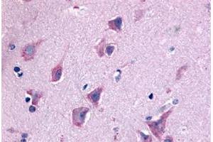 Immunohistochemical staining of human brain, neurons and glia with QRFPR polyclonal antibody . (QRFPR 抗体  (N-Term))