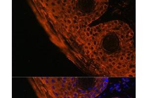 Immunofluorescence analysis of Mouse skin cells using TGM1 Polyclonal Antibody at dilution of 1:100. (TGM1 抗体)