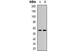 Western blot analysis of CD276 expression in MCF7 (A), HEK293T (B) whole cell lysates. (CD276 抗体)