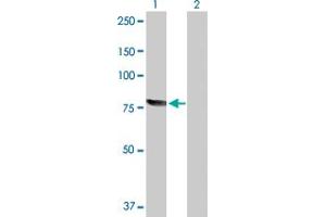 RecQ Protein-Like (DNA Helicase Q1-Like) (RECQL) (AA 1-649) 抗体