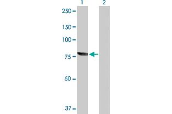 RecQ Protein-Like (DNA Helicase Q1-Like) (RECQL) (AA 1-649) 抗体