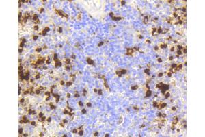 Immunohistochemistry of paraffin-embedded human spleen using LYZ antibody (ABIN5997039) at dilution of 1/100 (40x lens). (LYZ 抗体)