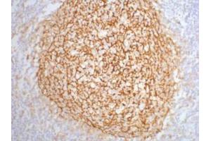 Immunohistochemistry (IHC) image for anti-Complement Component (3d/Epstein Barr Virus) Receptor 2 (CR2) antibody (ABIN3178613) (CD21 抗体)