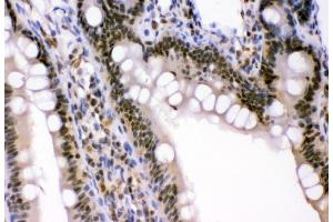 IHC analysis of p95 NBS1 using anti-p95 NBS1 antibody (ABIN3043282). (Nibrin 抗体  (C-Term))